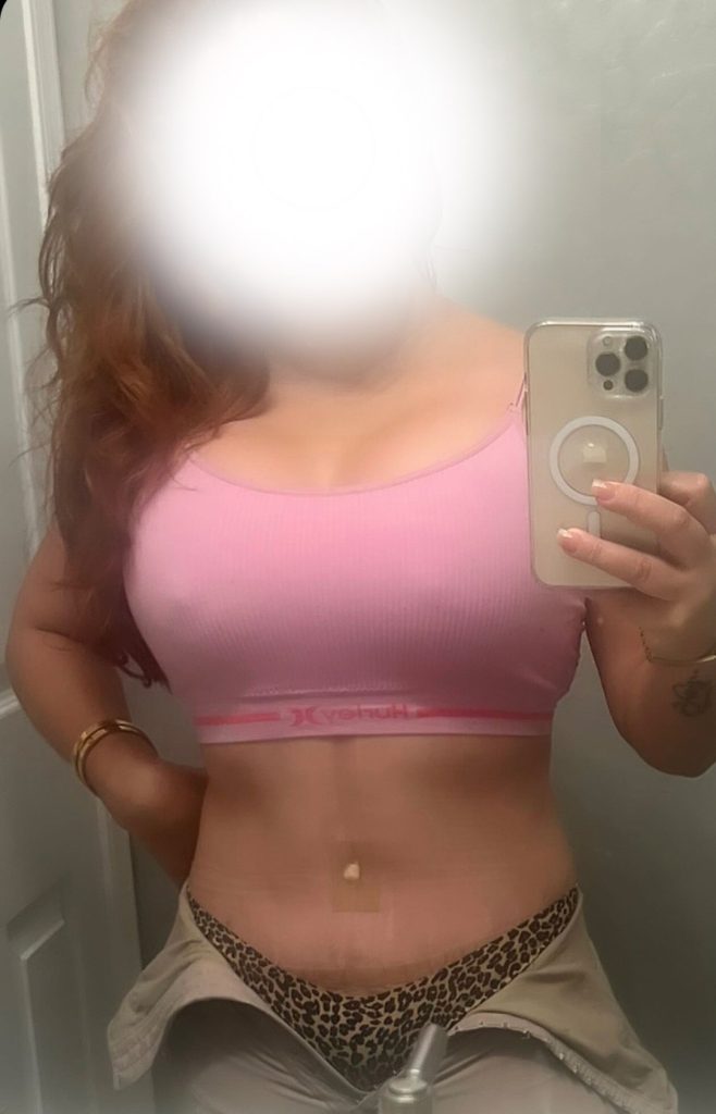 Patient Selfie Patient Selfie