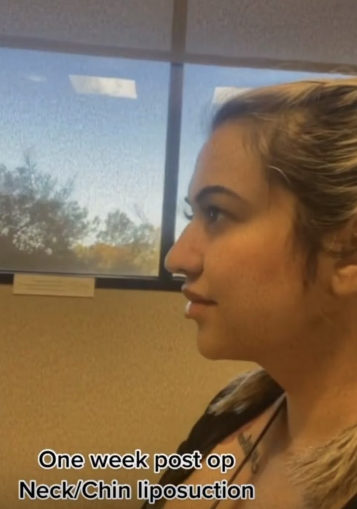 Patient Selfie Patient Selfie