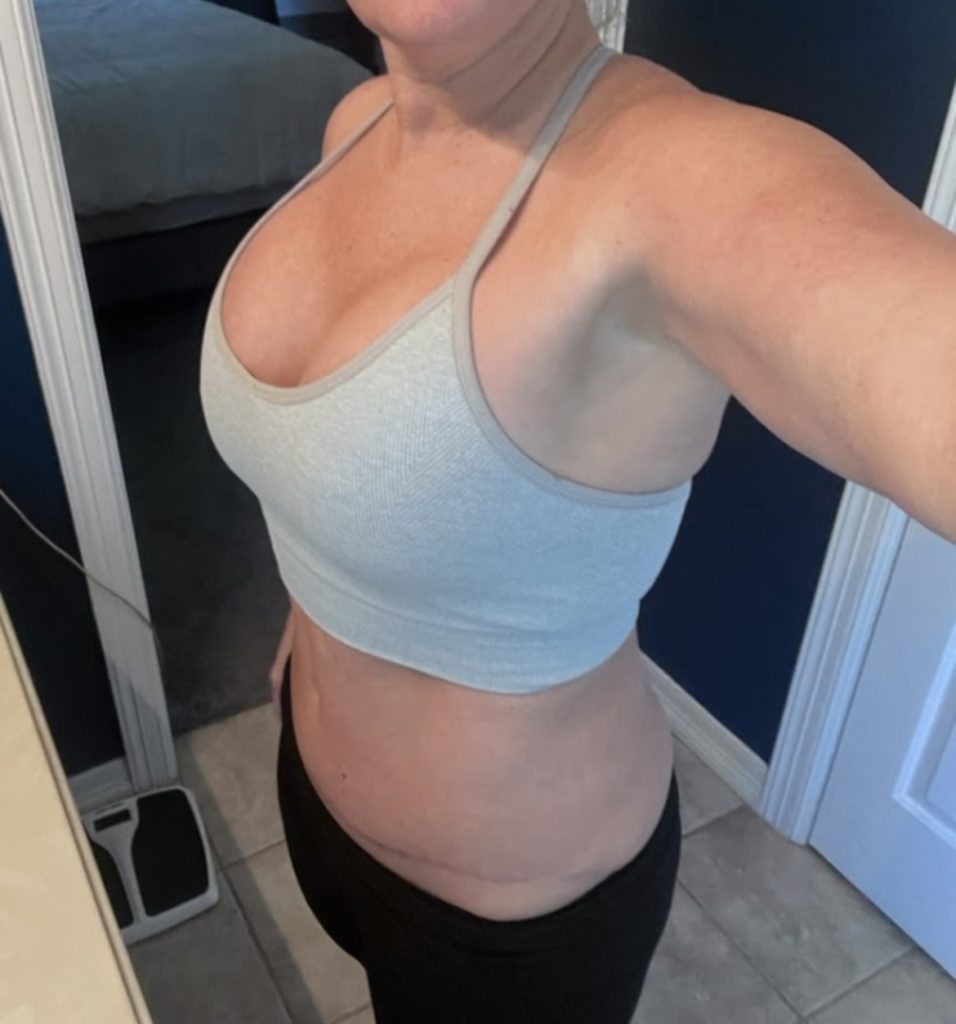 Patient Selfie Patient Selfie