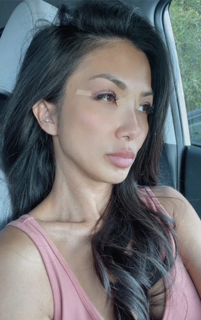 Patient Selfie Patient Selfie