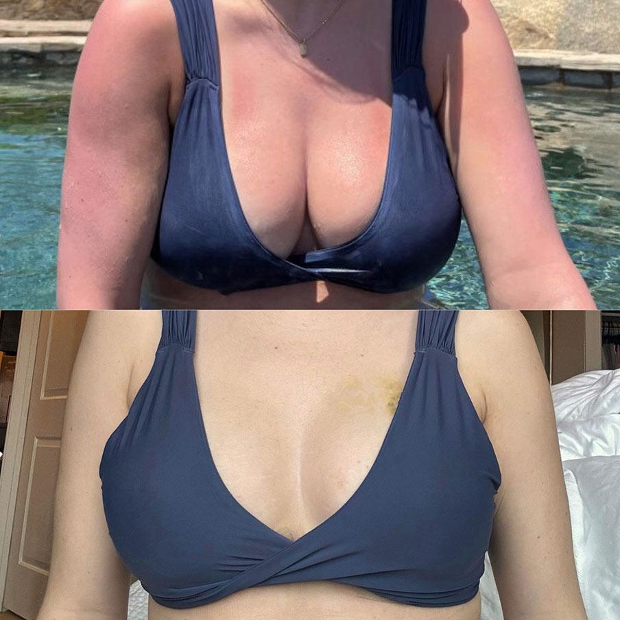patient selfie before&after Patient Selfie