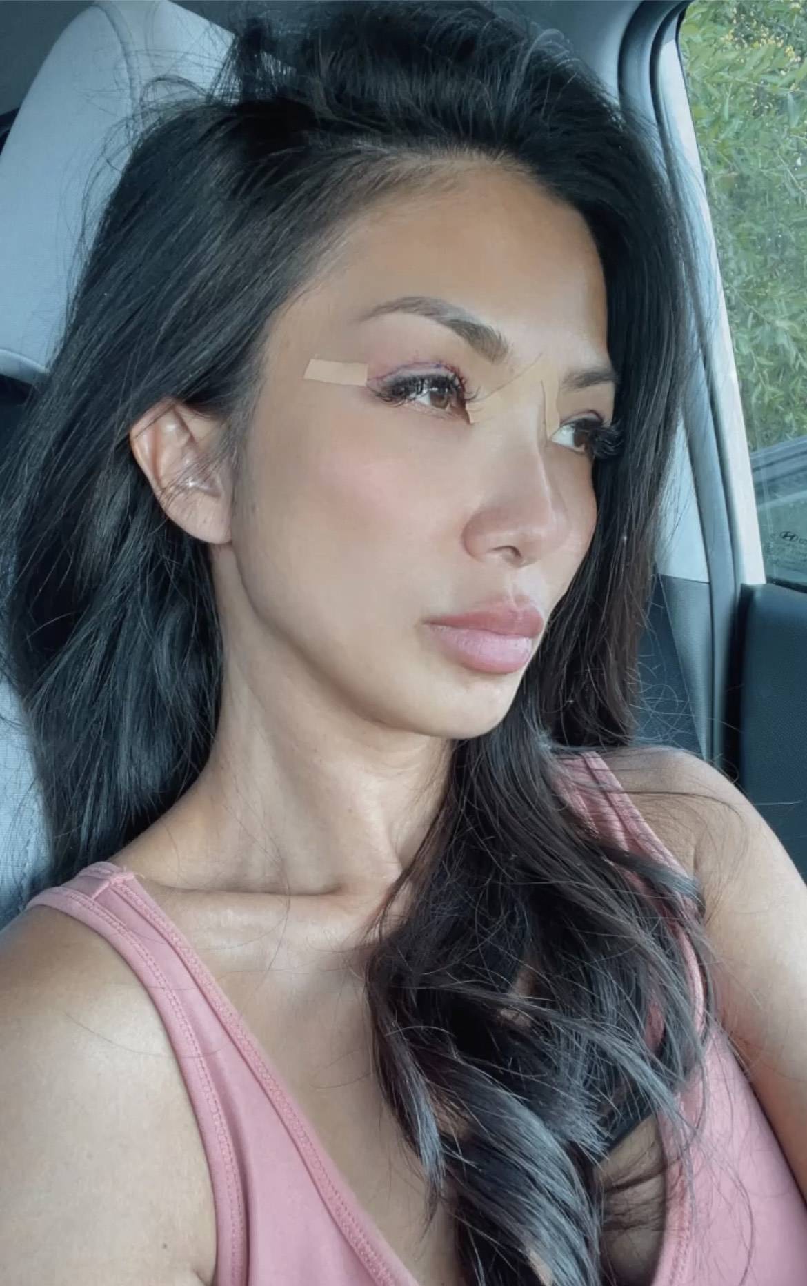 Patient Selfie
